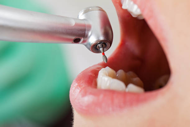 Best Emergency Care for Gum Disease in Mcarthur, OH